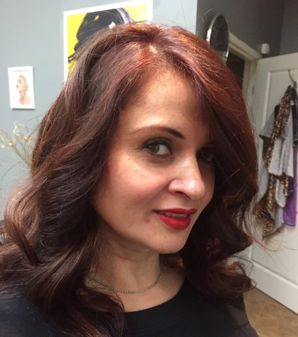 Hair Replacement Success Stories 7 Elisa Before