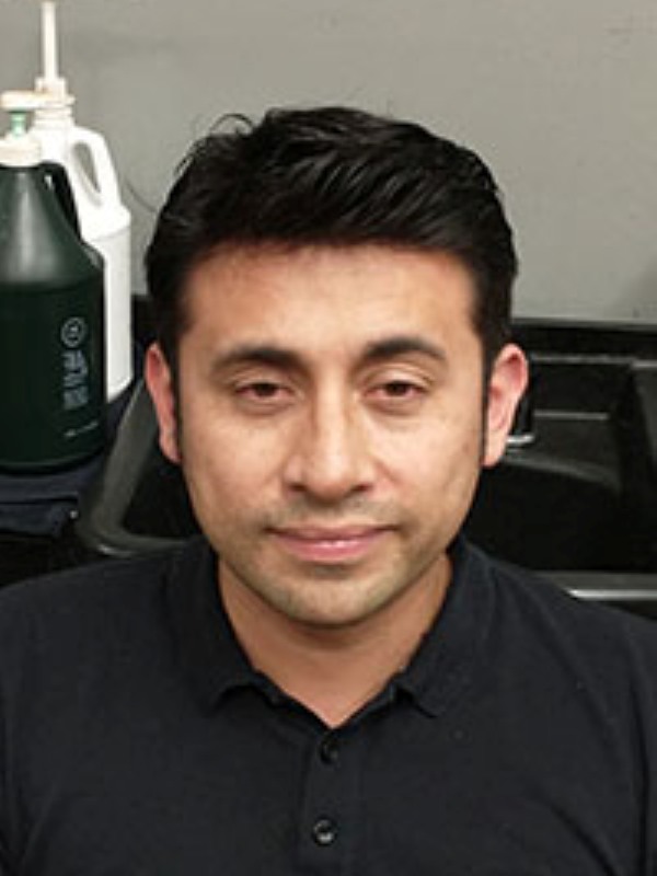 Hair Replacement Success Stories 14 Irwin After