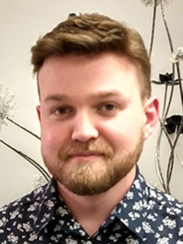 Hair Replacement Success Stories 17 Kurtis After
