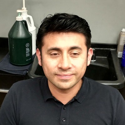 Thumbnail Erwin1 Copy Hair Restoration For Men