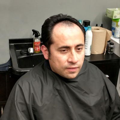 Thumbnail Erwin1 Chemo Related Hair Replacement