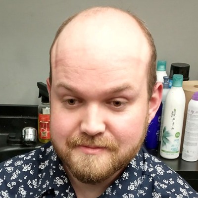 Thumbnail Kurtis 2 Chemo Related Hair Replacement