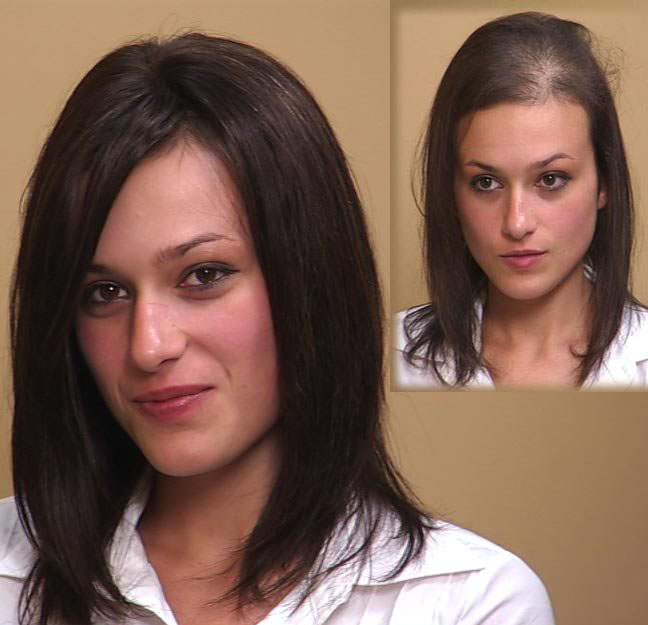female hair restoration update Hair Extensions
