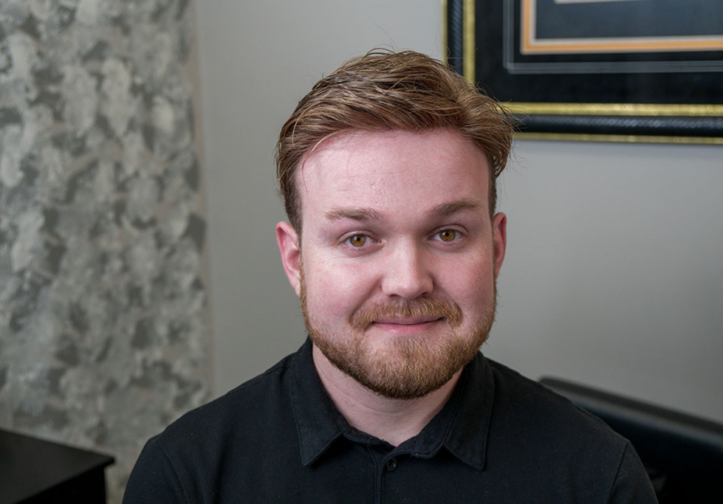 Non-Surgical Hair Replacement vs Transplants: Which Do I Want? 3 hair replacement vs transplant