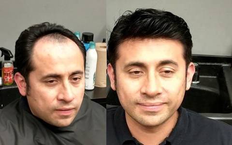 Erwin before and after photo with his new hair
