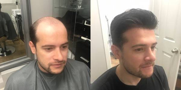 Joe showing how he looks with his hair back after visiting md hair design.