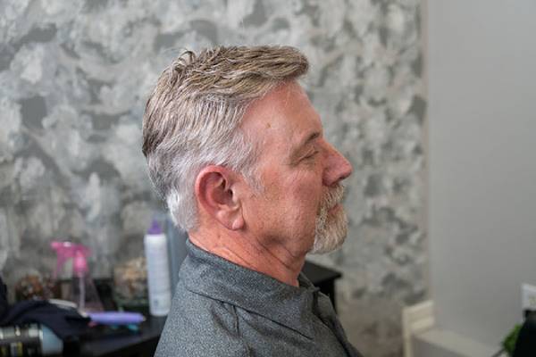 johnafter 400 600 450 675 Free Hair Replacement Consultation